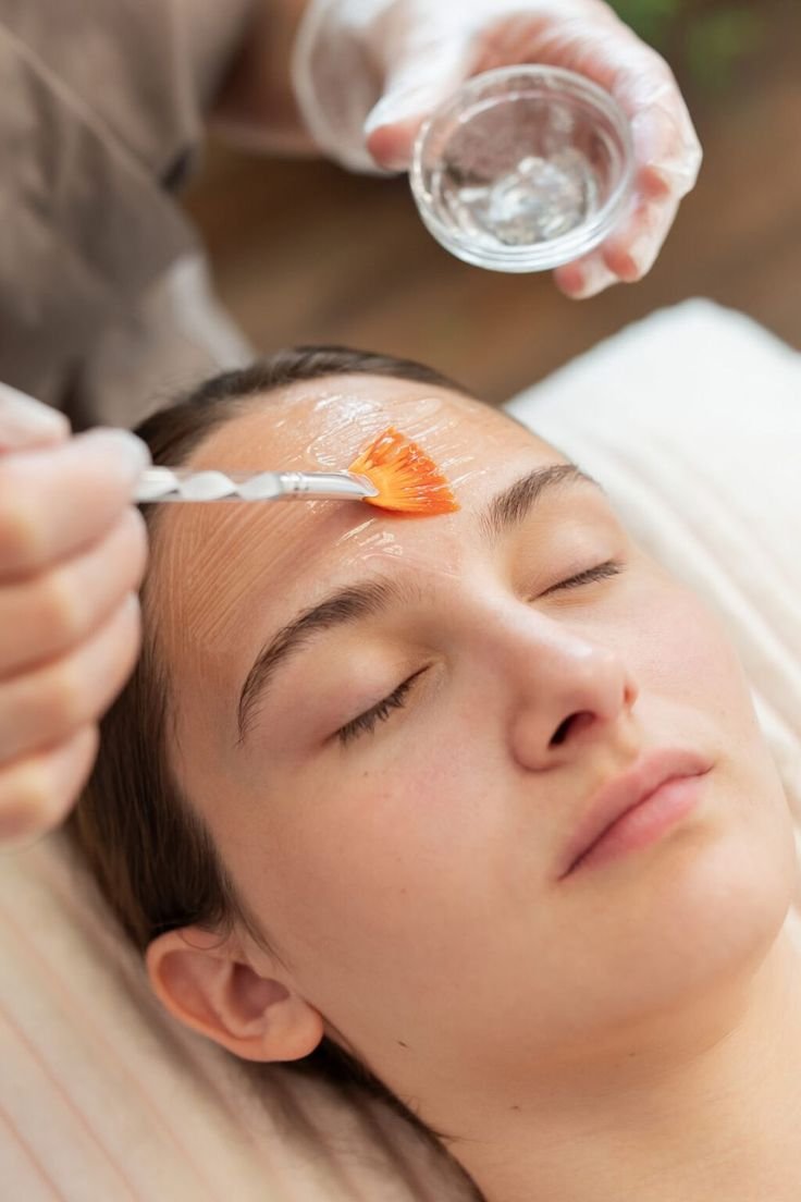 Chemical Peels