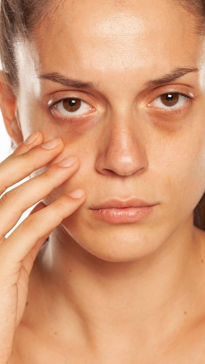Dull Skin