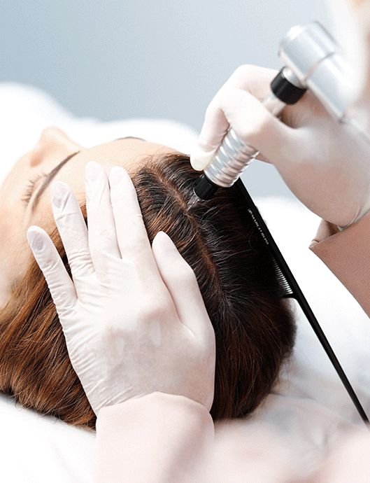 Mesotherapy for Hair