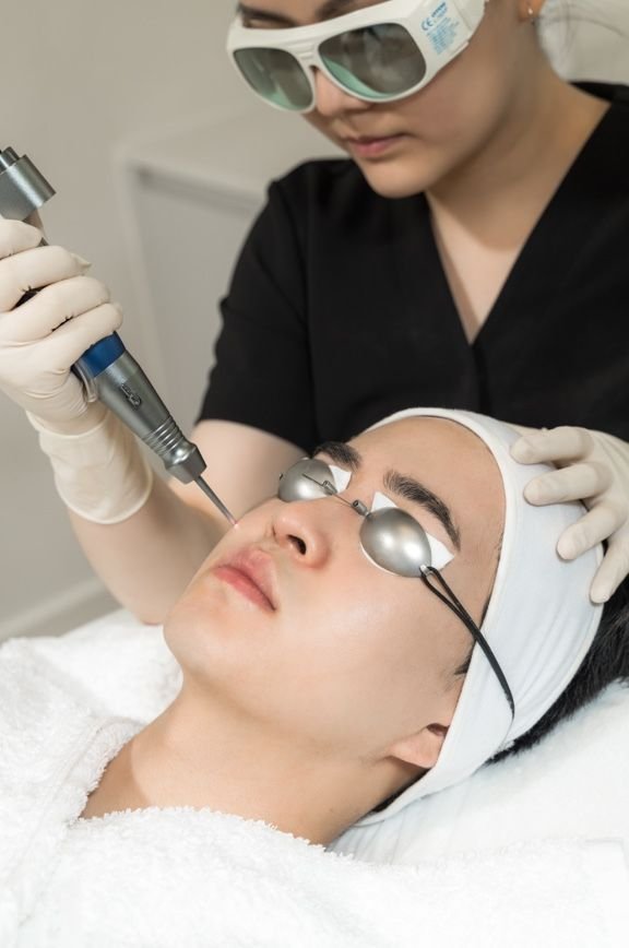 Laser Skin Rejuvenation