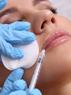 Fillers