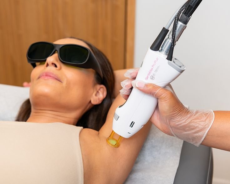 Laser Hair Reduction