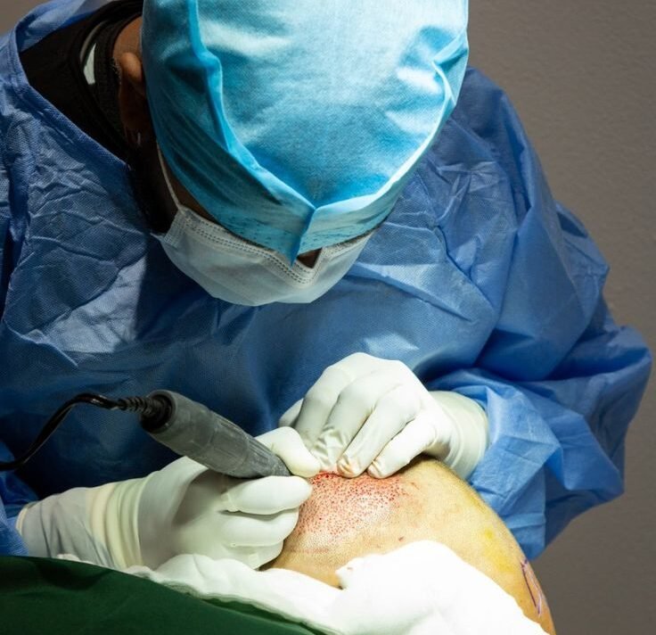 Hair Transplant