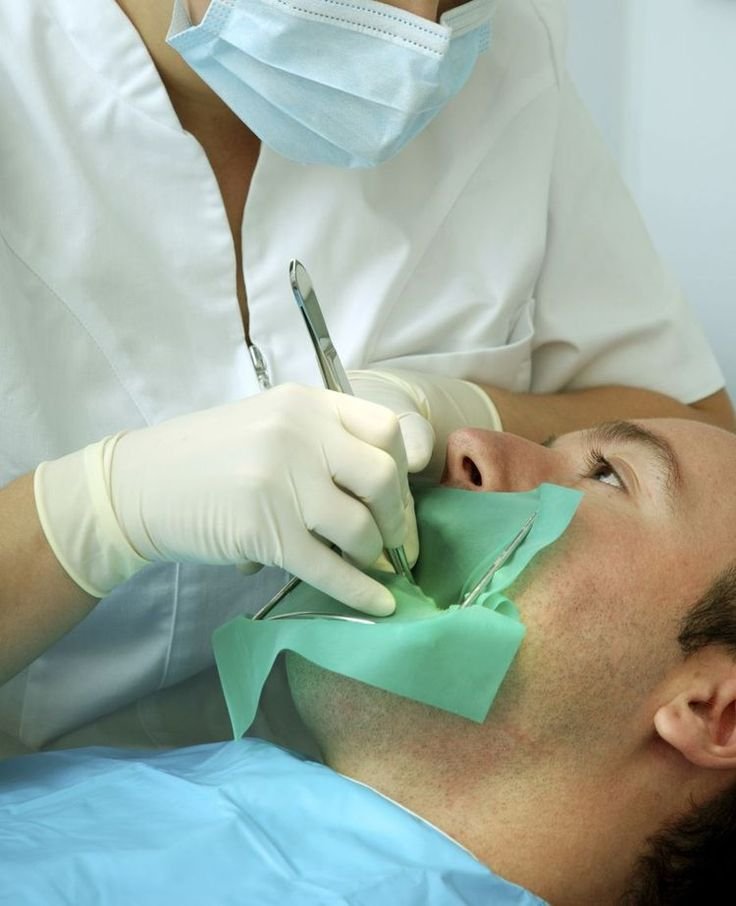 Root Canal